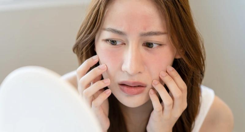 Giải tỏa 'stress' cho làn da mùa hè cùng hai thương hiệu mỹ phẩm Catrice - Essence - Ảnh 1.