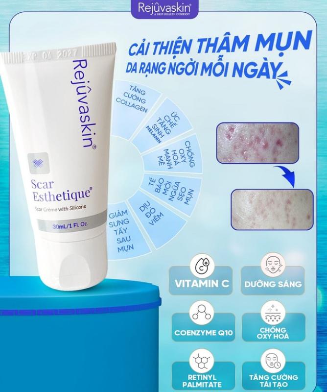 Bật mí cách trị thâm mụn hiệu quả tại nhà, kể cả thâm nặng và lâu năm- Ảnh 1. Bật mí cách trị thâm mụn hiệu quả tại nhà, kể cả thâm nặng và lâu năm- Ảnh 1.