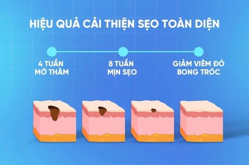 Kiến trúc làn da: ‘vật liệu’ nào giúp tái xây nền da, lấp đầy sẹo lõm? - Ảnh 2.
