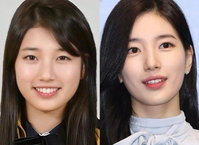 Sự thay đổi ngoại hình đáng kinh ngạc của Suzy - Ảnh 1.