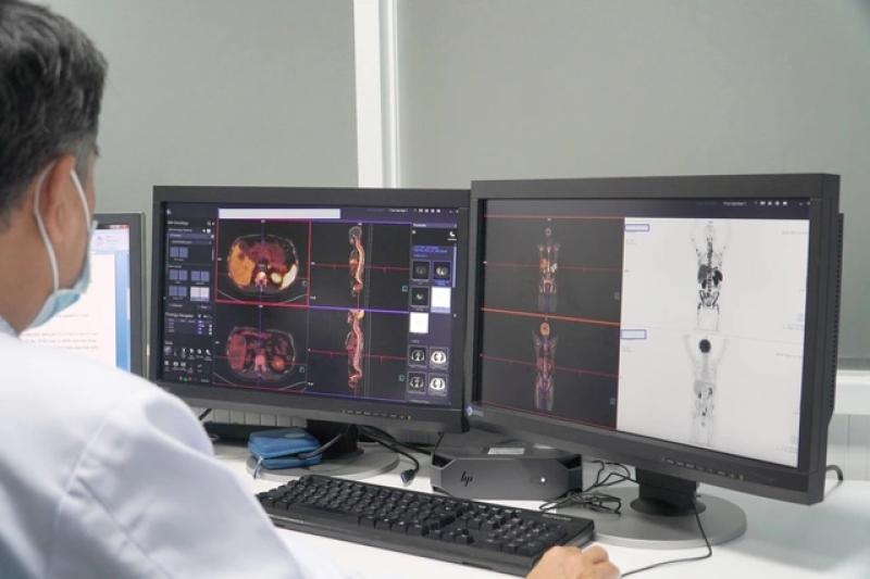 Bệnh viện Chợ Rẫy nói về dừng lò sản xuất phóng xạ dùng cho máy PET-CT - Ảnh 3.