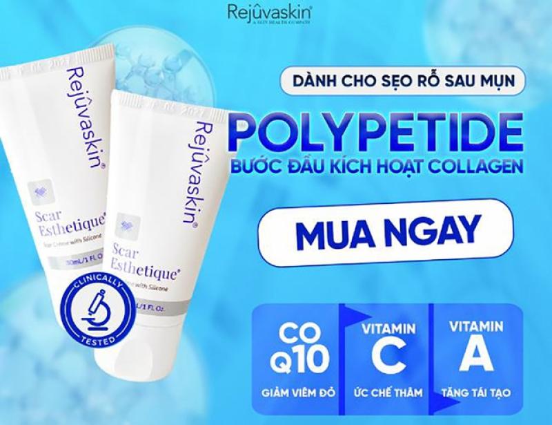 Scar Esthetique: Giải pháp kích tăng sinh collagen cho sẹo lõm mịn da- Ảnh 1. Scar Esthetique: Giải pháp kích tăng sinh collagen cho sẹo lõm mịn da- Ảnh 1.
