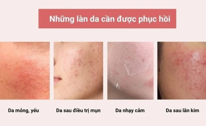 Khi nào làn da cần phục hồi? - Ảnh 1.