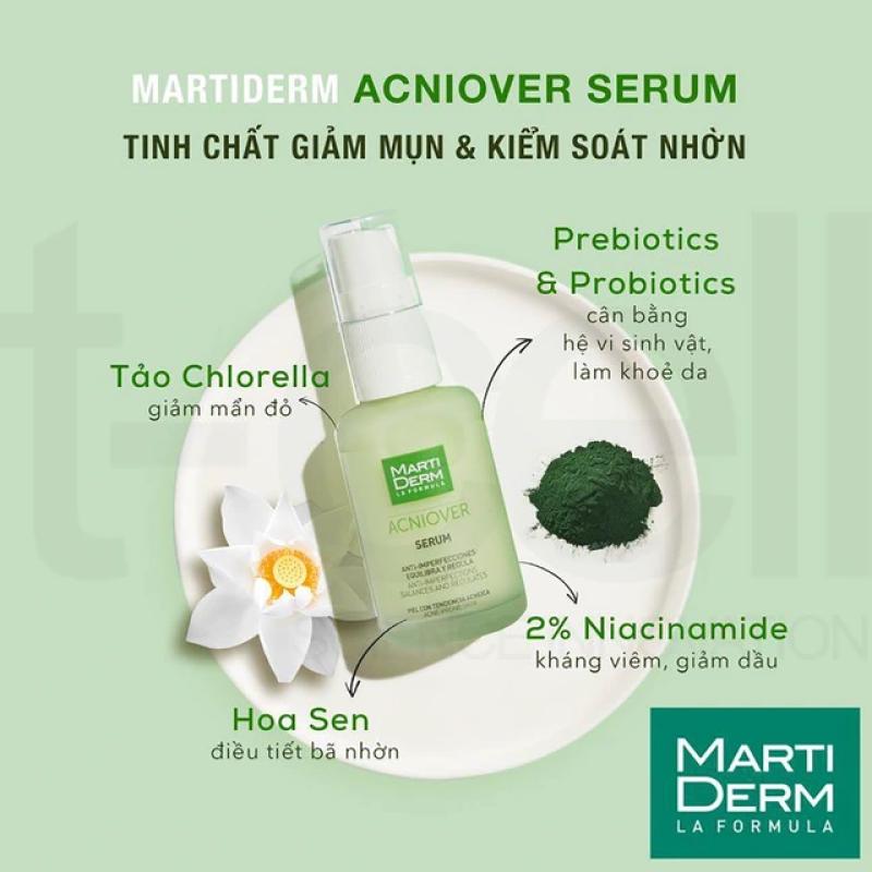 Top 7 kem trị mụn tuổi dậy thì hiệu quả nhanh chóng giúp gen Z tự tin- Ảnh 9. Top 7 kem trị mụn tuổi dậy thì hiệu quả nhanh chóng giúp gen Z tự tin- Ảnh 9.