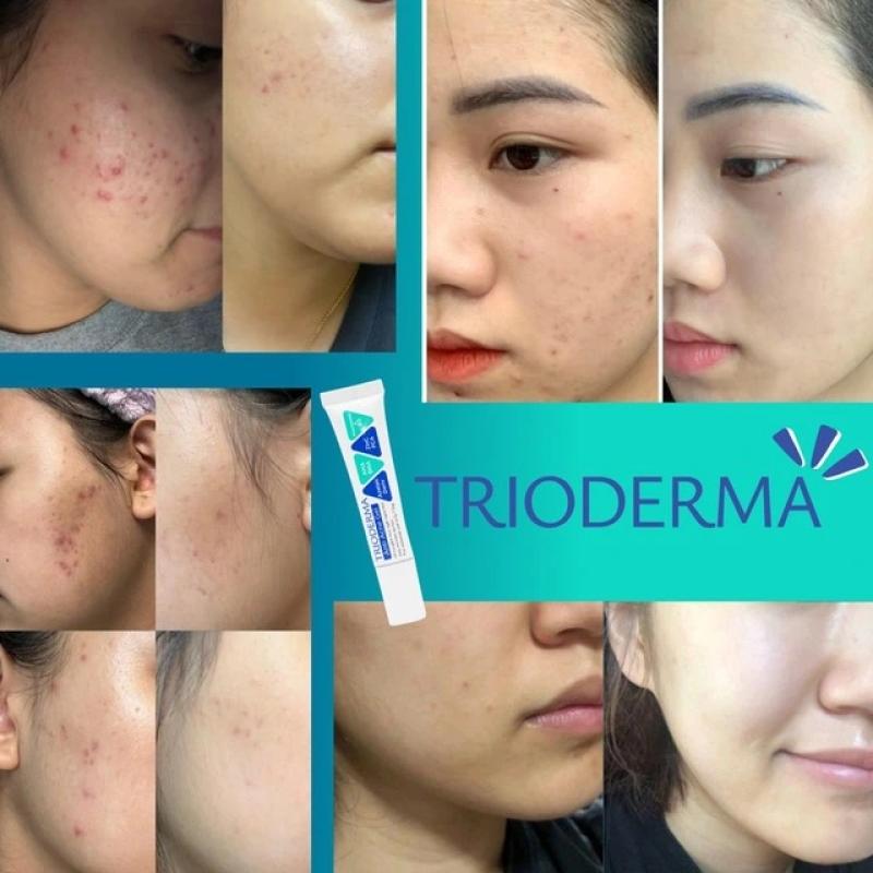 Dược mỹ phẩm Trioderma có tốt không mà được tìm mua nhiều như vậy? - Ảnh 4.