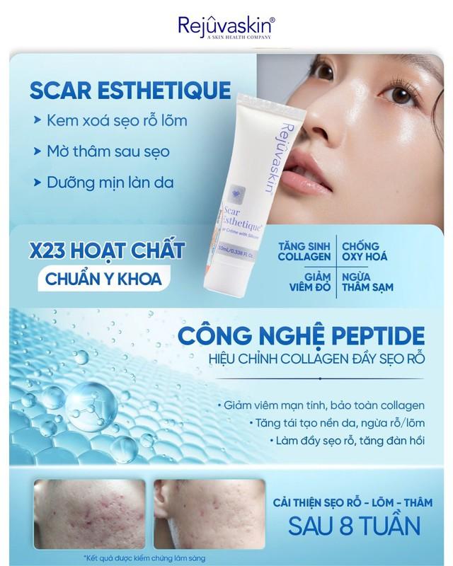 Cách ngừa sẹo và trị sẹo chuẩn y khoa hiệu quả tại nhà không cần xâm lấn - Ảnh 8.