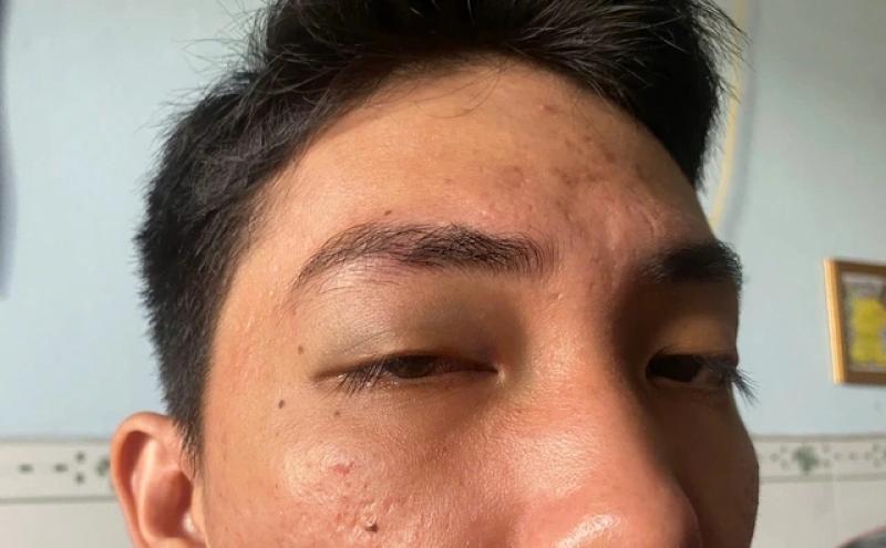 Tài xế ô tô bị hành hung vì quay phim xe tải chắn lối đi - Ảnh 3.