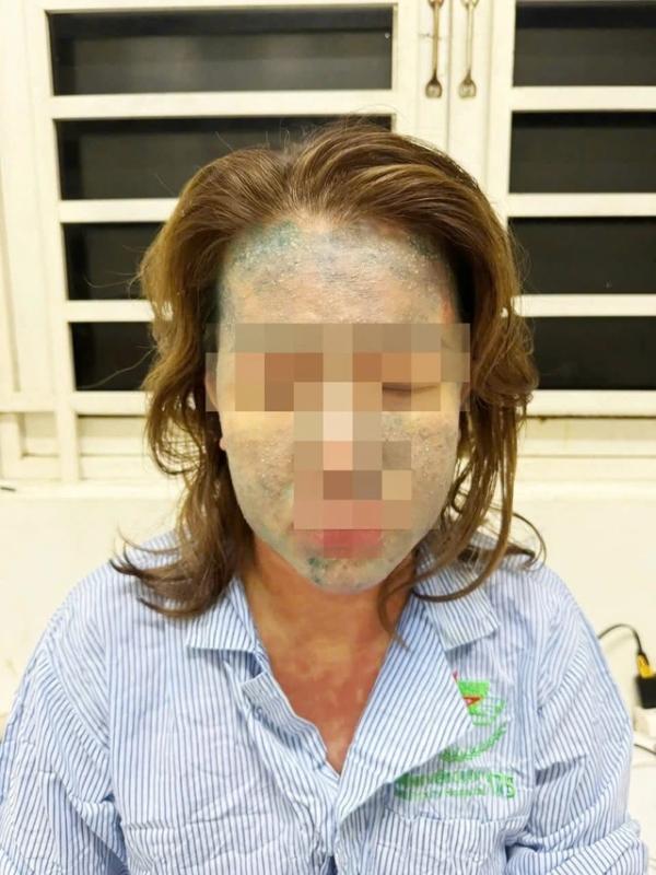 Nguy kịch vì dùng thuốc giảm cân, collagen 'xách tay' - Ảnh 1.