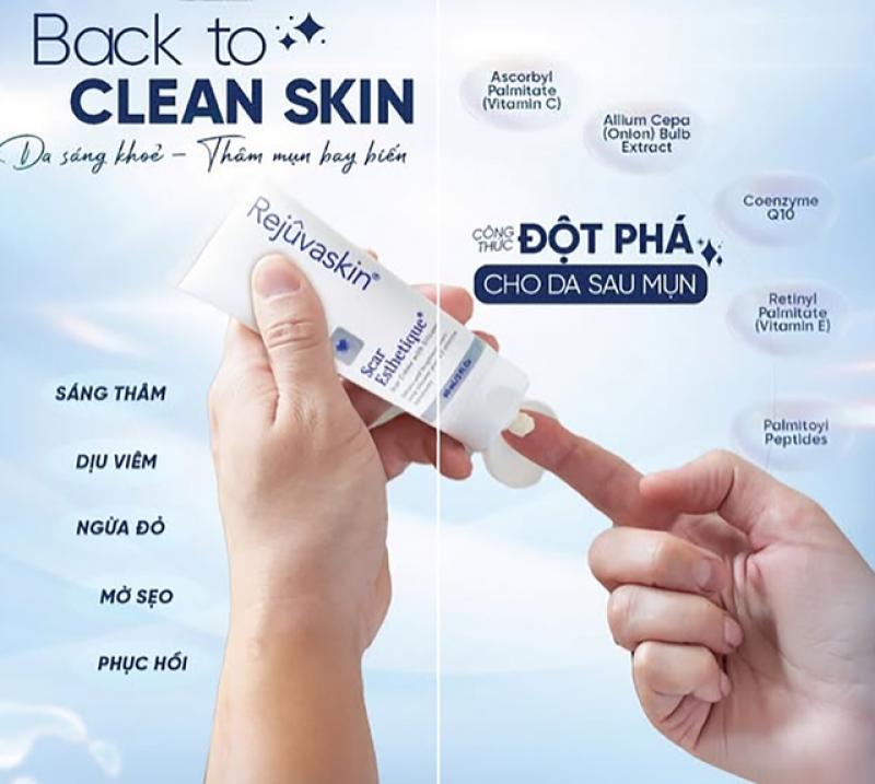 Bật mí cách trị thâm sau khi nặn mụn chuẩn y khoa hiệu quả ngay tại nhà- Ảnh 1. Bật mí cách trị thâm sau khi nặn mụn chuẩn y khoa hiệu quả ngay tại nhà- Ảnh 1.