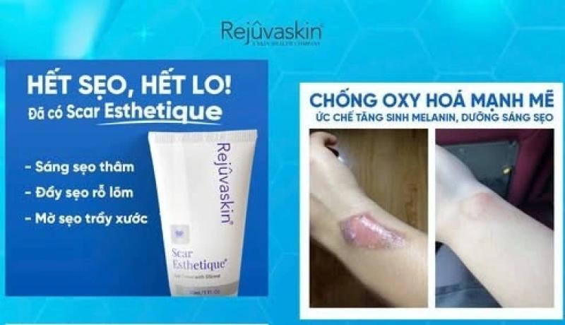 Sẹo lâu năm hay cứng đầu đến mấy cũng mờ hẳn nhờ kem trị sẹo này- Ảnh 1. Sẹo lâu năm hay cứng đầu đến mấy cũng mờ hẳn nhờ kem trị sẹo này- Ảnh 1.