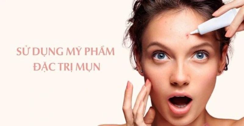 Cách sử dụng kem trị mụn hiệu quả, ngăn ngừa tái phát - Ảnh 1.