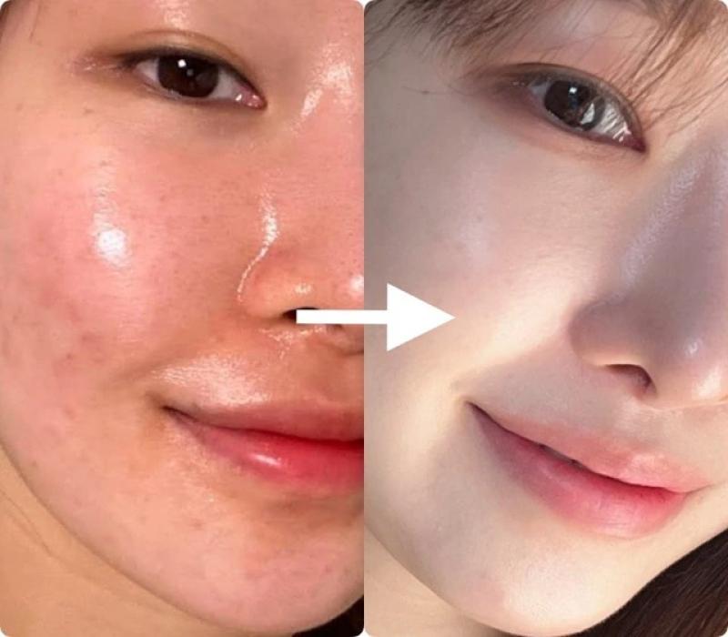 Top 7 kem dưỡng trắng da chống hóa cho tuổi 40 trẻ mãi, thời gian bỏ quên - Ảnh 1.