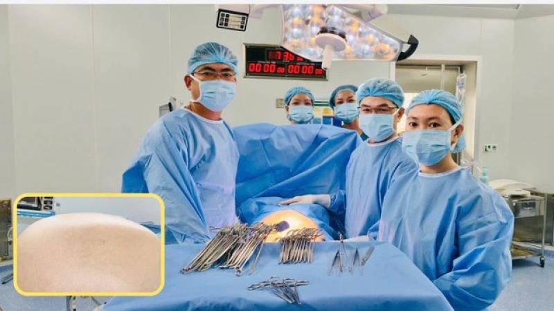Tưởng tăng cân, người phụ nữ phát hiện khối u buồng trứng to hơn mang tam thai - Ảnh 1.