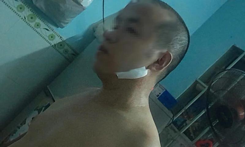 TP.HCM: Vợ chồng công nhân bị đạp xe, hành hung dã man sau ca làm đêm- Ảnh 2. TP.HCM: Vợ chồng công nhân bị đạp xe, hành hung dã man sau ca làm đêm- Ảnh 2.