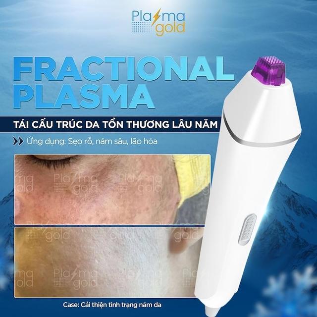 Plasma Gold: Hành trình chinh phục toàn cầu của công nghệ thẩm mỹ đột phá- Ảnh 3. Plasma Gold: Hành trình chinh phục toàn cầu của công nghệ thẩm mỹ đột phá- Ảnh 3.