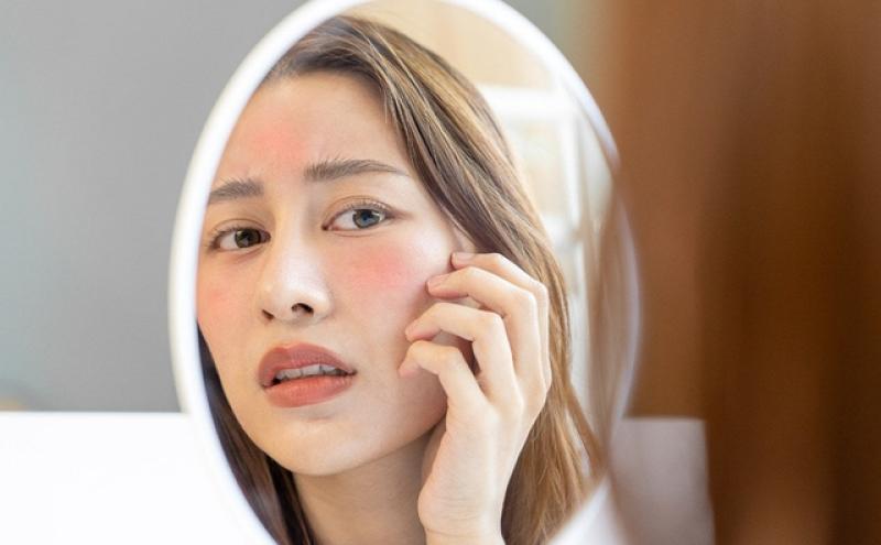 Top 7 sản phẩm làm dịu da đỏ, kích ứng sau laser hiệu quả- Ảnh 1. Top 7 sản phẩm làm dịu da đỏ, kích ứng sau laser hiệu quả- Ảnh 1.
