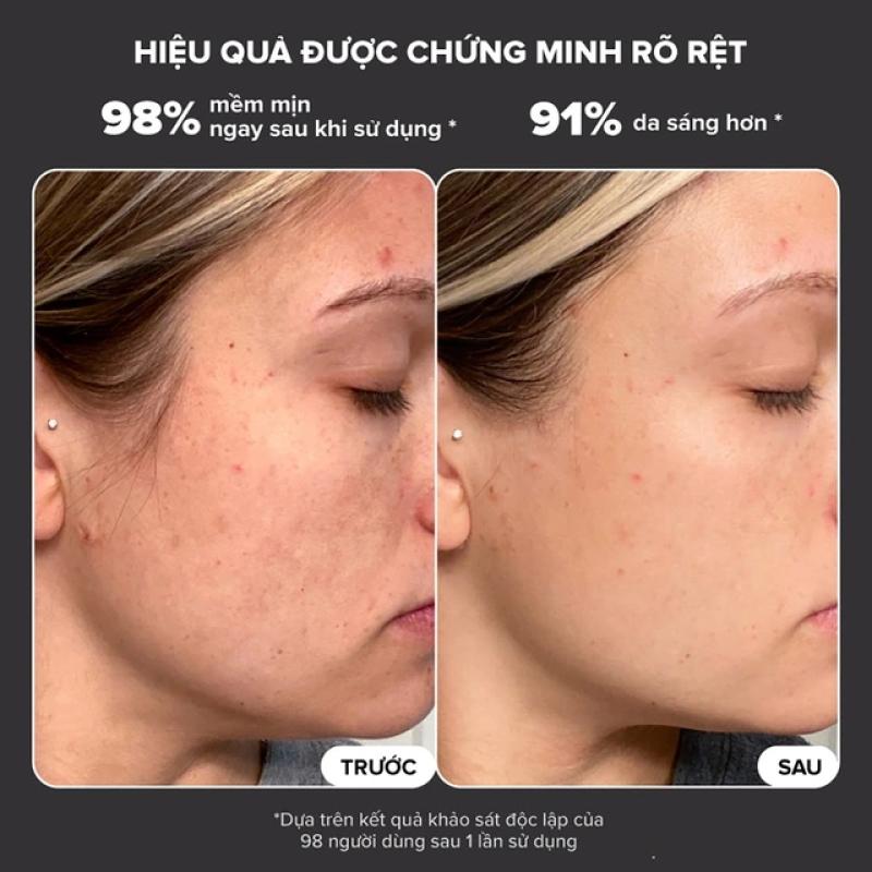 Top 5 tẩy tế bào chết cho da mặt bật tone, top đầu còn căng bóng glowy- Ảnh 7. Top 5 tẩy tế bào chết cho da mặt bật tone, top đầu còn căng bóng glowy- Ảnh 7.